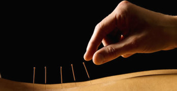 Benefits Of Acupuncture - article head image